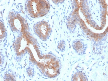 Mammaglobin A Antibody / SCGB2A2