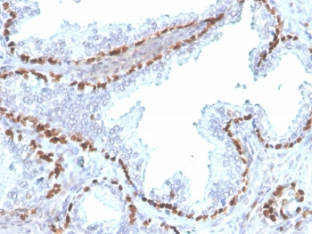 p40 / deltaNp63 Antibody