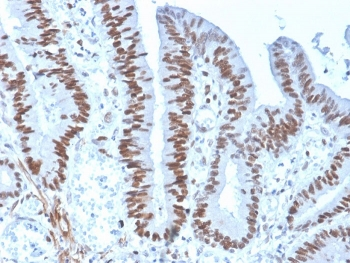 MSH6 Antibody