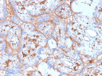 PD-L1 Antibody / B7-H1 / CD274