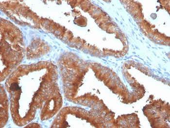 PSA / Prostate Specific Antigen Antibody