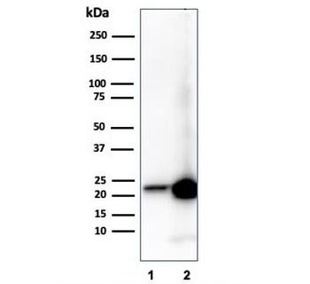 Retinol Binding Protein 4 Antibody / RBP4