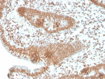 PMS2 Antibody / PMS1 homolog 2