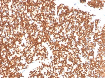 Steroidogenic Factor 1 Antibody / SF-1 / NR5A1