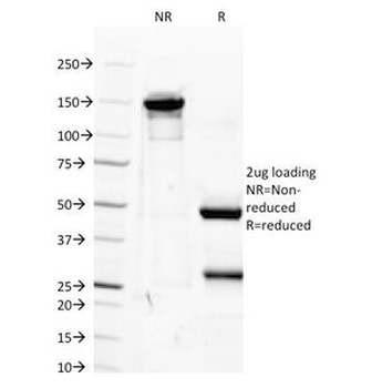 IGF-1 Antibody / Insulin like Growth Factor 1