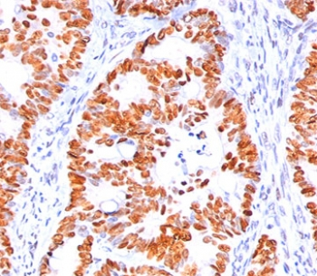 p53 Antibody / TP53 (N-Terminal Region)