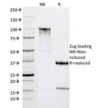 HLA-DR Antibody (MHC II)