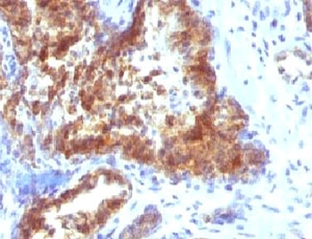 PSA / Prostate Specific Antigen Antibody
