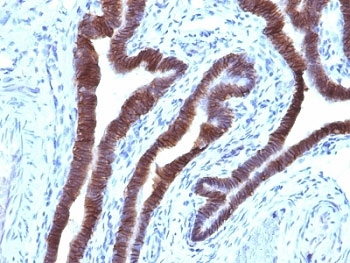 EpCAM Antibody / Cytoplasmic domain