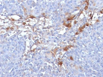 CD146 Antibody / MCAM / MUC18