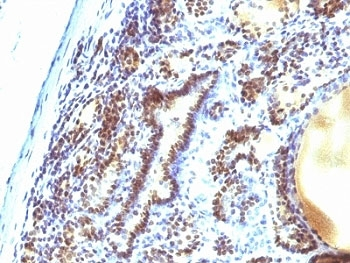 MAP3K1 Antibody (MEKK1)