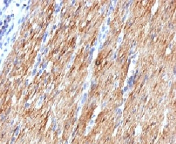 SMMHC Antibody (Smooth Muscle Myosin Heavy Chain)