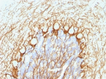 Neurofilament Antibody, phospho (NF-H)