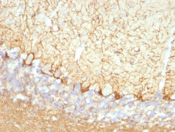 Neurofilament Antibody (-Light) / NF-L / NEFL