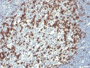 PDCD1 Antibody / PD-1 / PD1