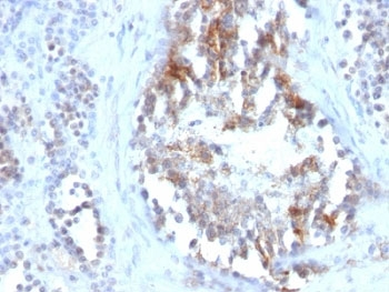 SHBG Antibody (Sex Hormone Binding Globulin)