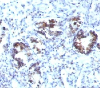SM22 alpha Antibody / Transgelin