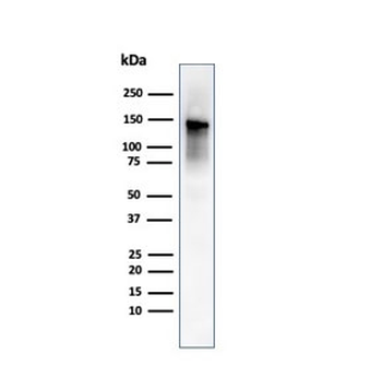 Caldesmon / CAD Antibody HMW