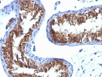 MVP Antibody / Major Vault Protein