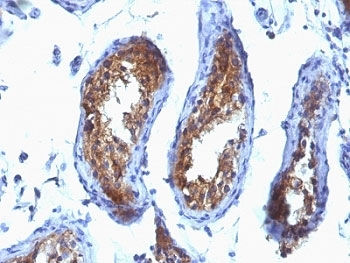 MVP Antibody / Major Vault Protein