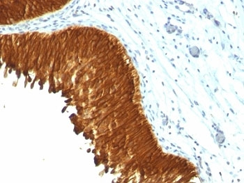 Multi Cytokeratin Antibody