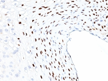 HPV-16 L1 Antibody