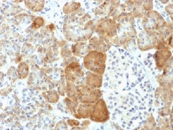 VLDLR Antibody / VLDL Receptor