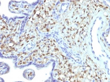 S100A4 Antibody / FSP1