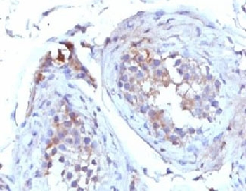 SHBG Antibody (Sex Hormone Binding Globulin)