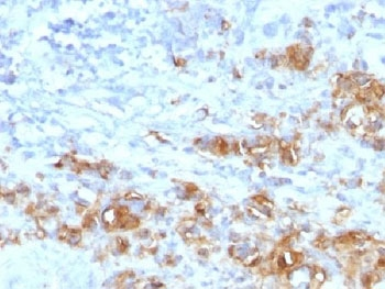 CA19-9 Antibody