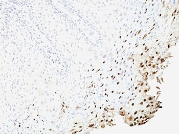 HPV-16 L1 Antibody