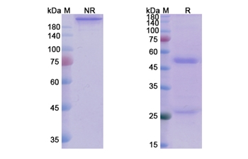 Andecaliximab (MMP9) - Research Grade Biosimilar Antibody