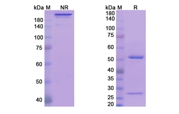 Avizakimab (IL21) - Research Grade Biosimilar Antibody