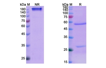 Denosumab (TNFSF11/CD254) - Research Grade Biosimilar Antibody