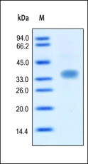 Oncostatin M Recombinant Protein