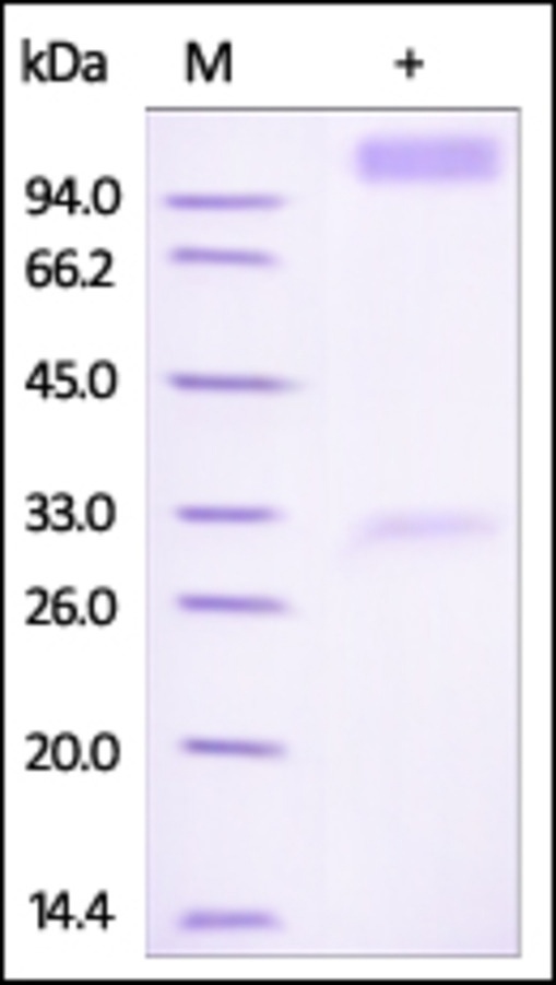 IFNAR 1 Recombinant Protein