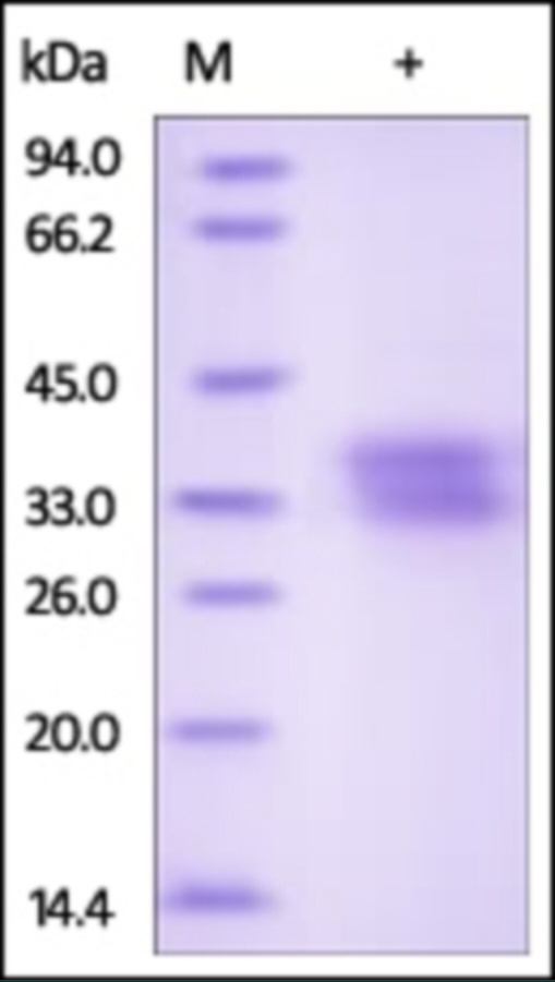 Ephrin B1 Recombinant Protein