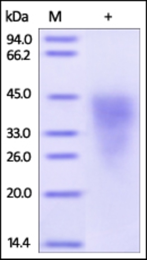 IGSF16 Recombinant Protein