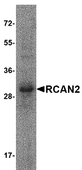 RCAN2 Isoform 2 Recombinant Protein