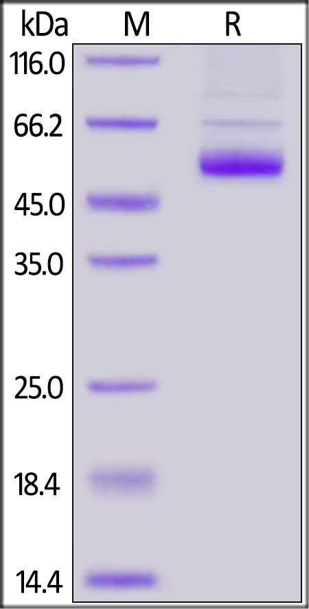 TNFSF11 / RANKL / CD254 Recombinant Protein