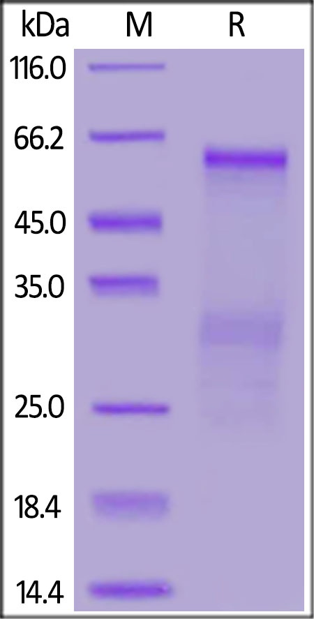 SARS-CoV Nucleocapsid Recombinant Protein
