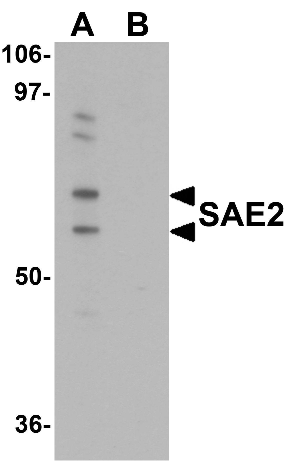 SAE2 Peptide
