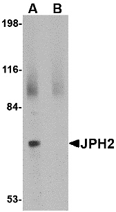 JPH2 Peptide