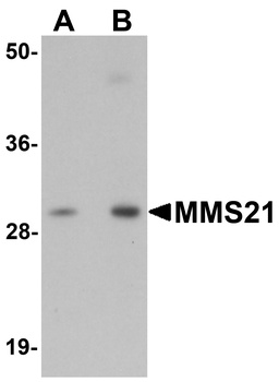 NSMCE2 Antibody