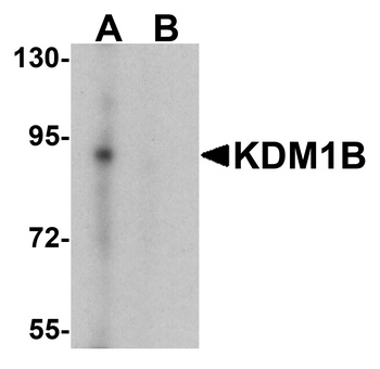 KDM1B Antibody