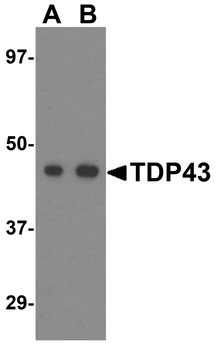 TARDBP Antibody