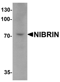 NBN Antibody
