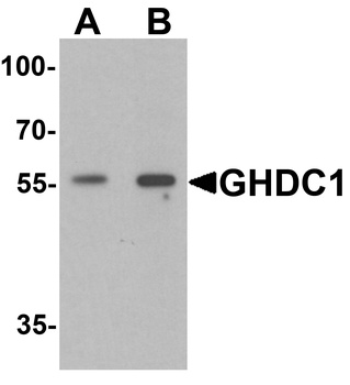 GHDC Antibody