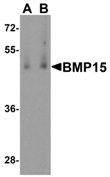 BMP15 Antibody