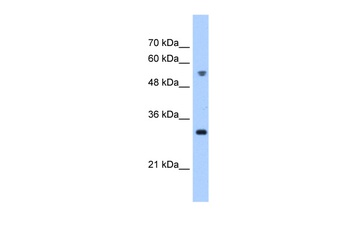 TTC5 Antibody